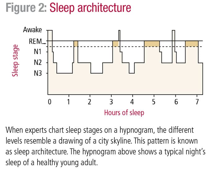 Sleep architecture